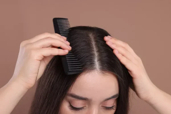 Healthy Scalp