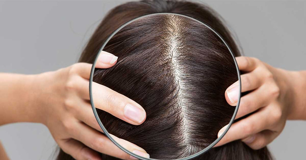 Tips for Achieving a Healthy Scalp